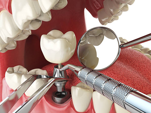 Best Pediatric Emergency Dentist in Manly, IA